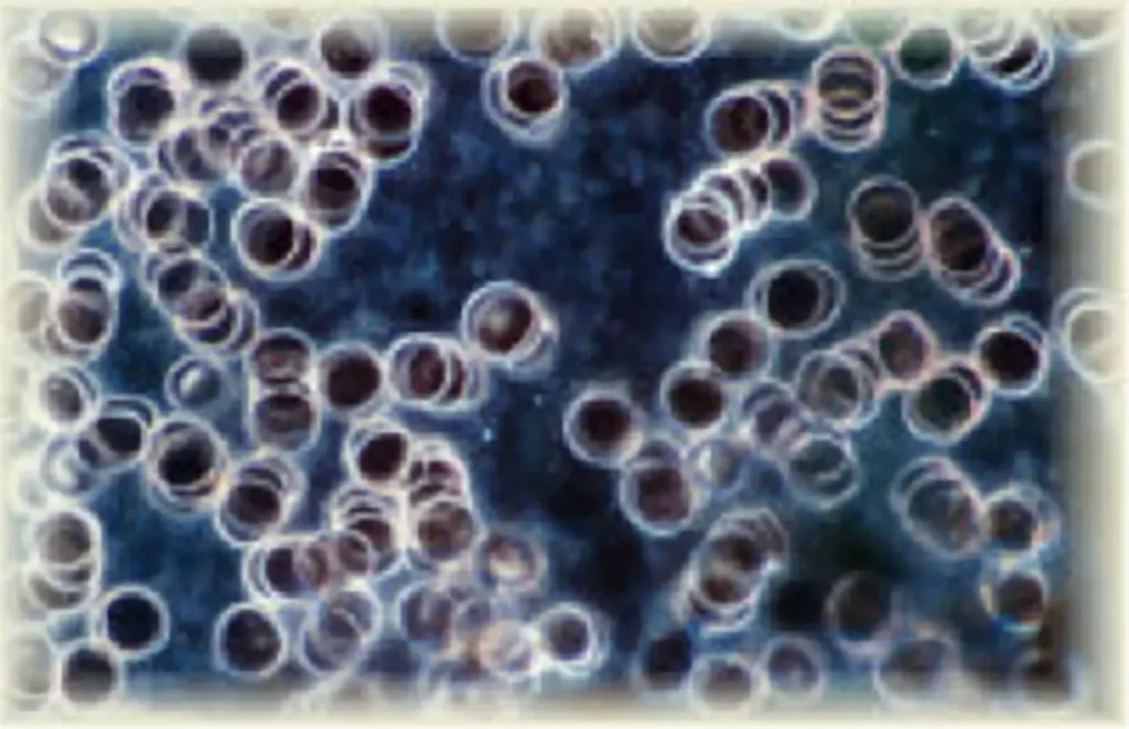 Mikroskopische Aufnahme von roten Blutkörperchen vor dunklem Hintergrund zur Darstellung in der Dunkelfeldmikroskopie.