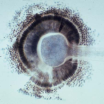 Aspergillus2