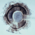 Aspergillus2